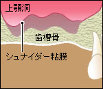 サイナフリフト1