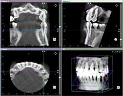 歯科用ＣＴの特徴