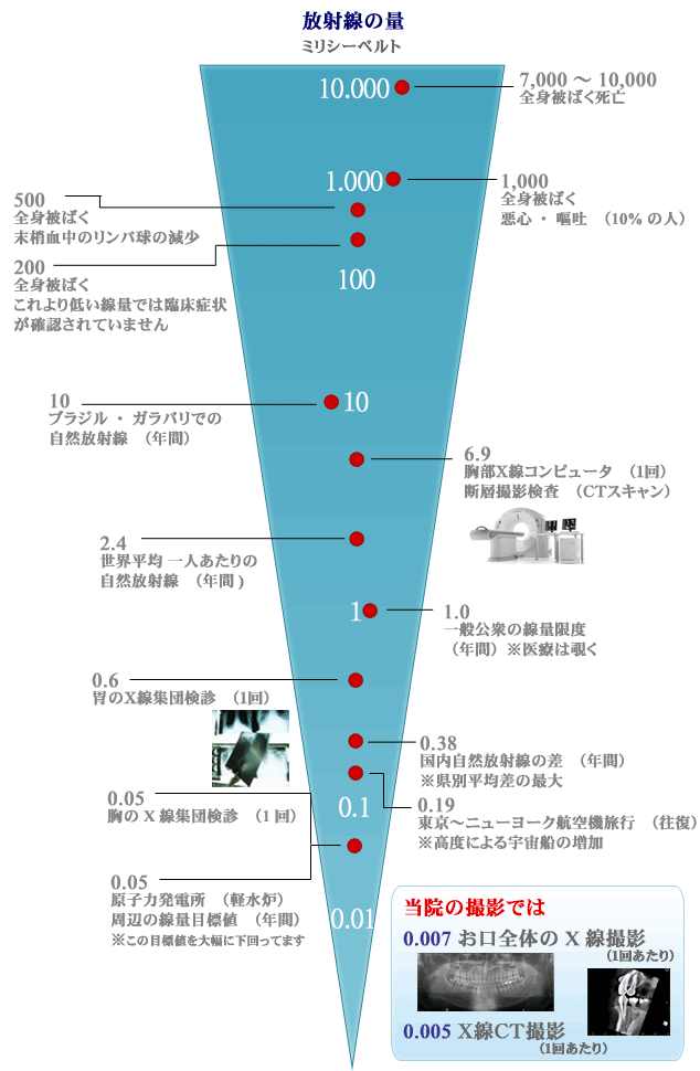 歯科用ＣＴは低被ばく