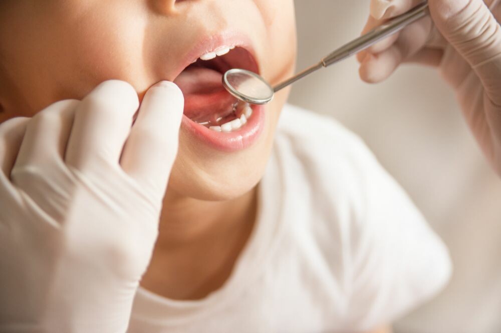 お子様の虫歯になりやすい時期、虫歯になりやすい場所があるのことをご存じでしょうか？
