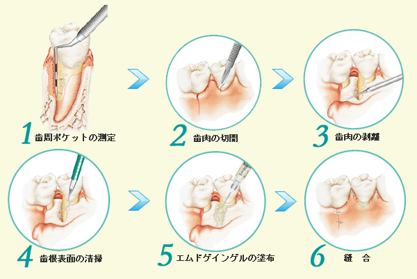 エムドゲイン